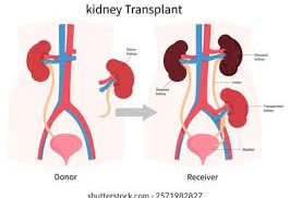 Protecting the Gift of Life: How to Prevent Organ Rejection After Kidney Transplant Protecting the Gift of Life: How to Prevent Organ Rejection After Kidney Transplant